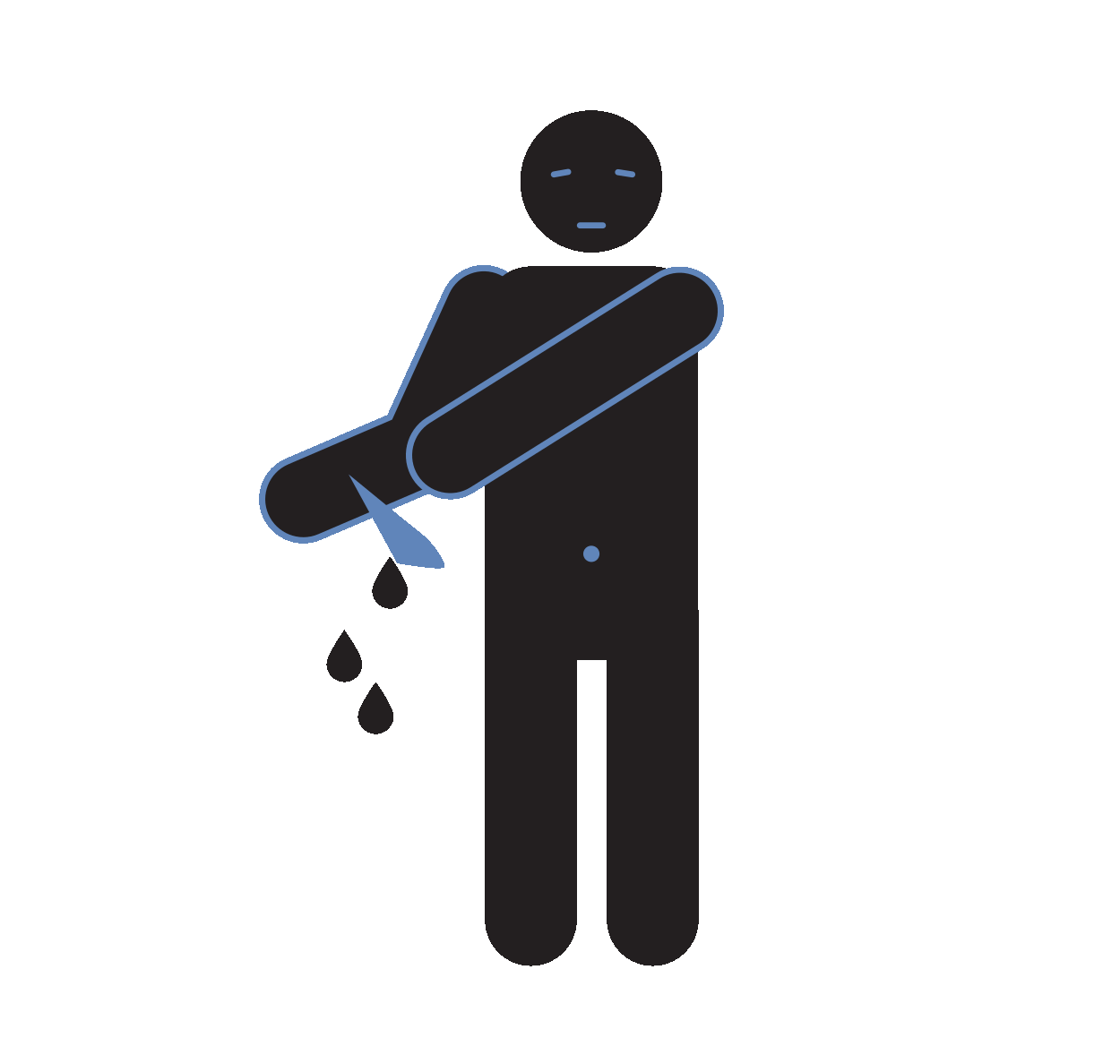 Severe cuts that may require stitches