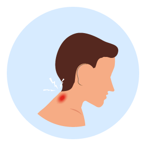 Neck strain
